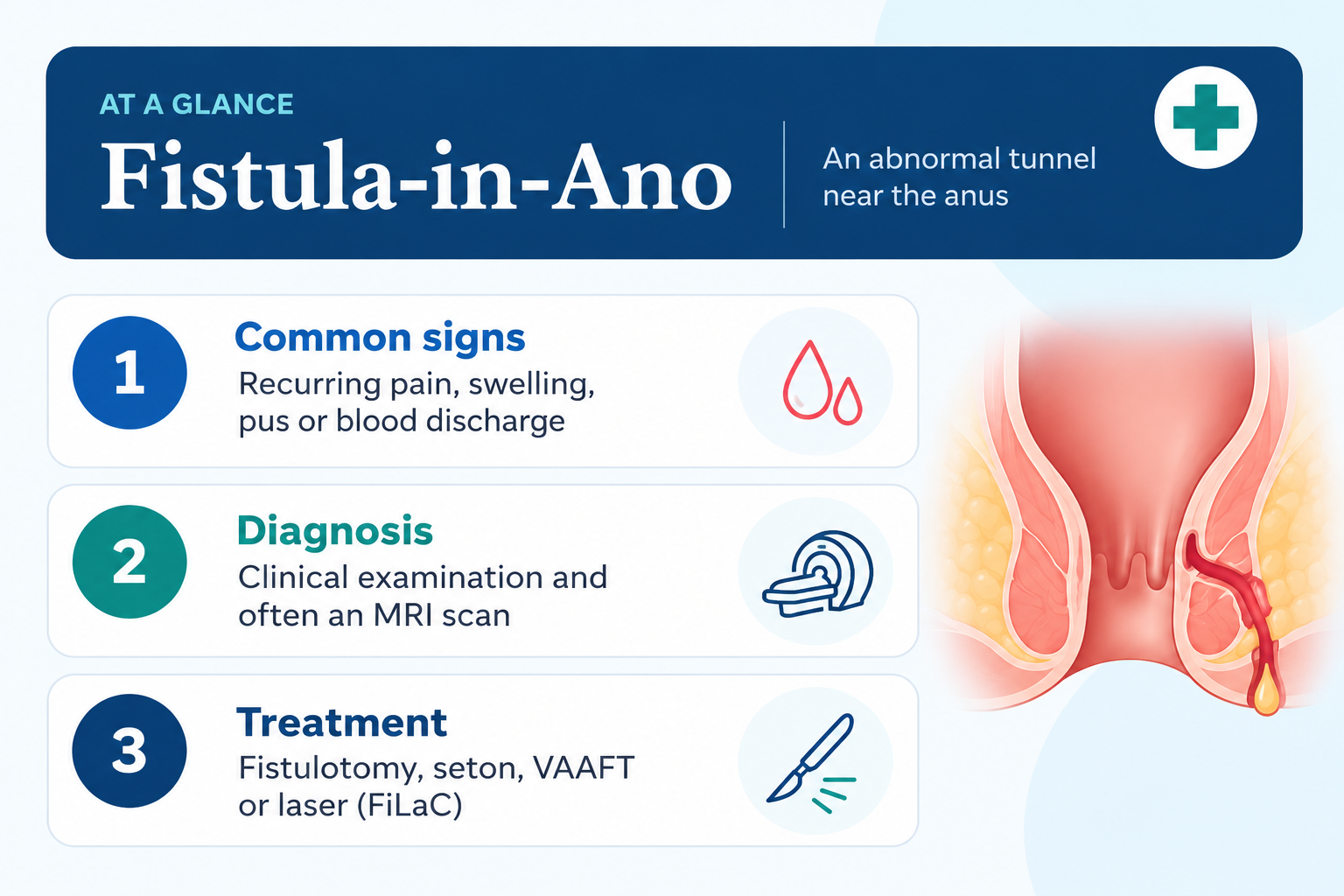 Fistula-in-Ano infographic